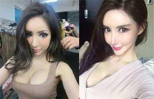 网红的假胸
