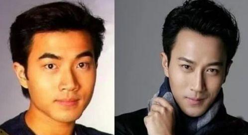 娱乐圈吃瓜爆料男星整容